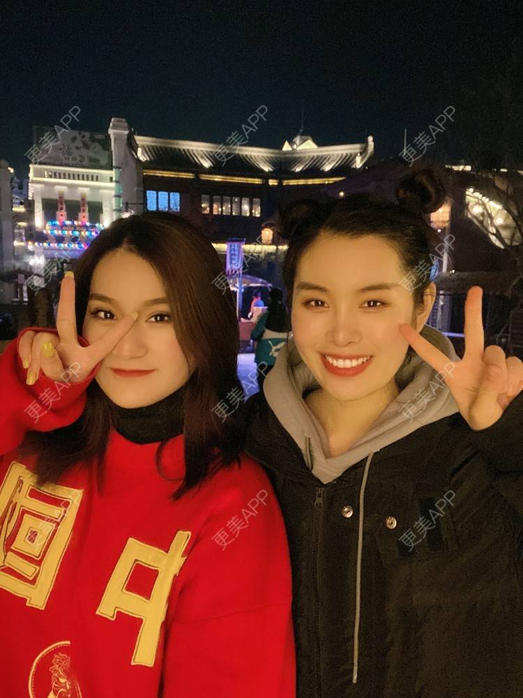 更美 - 邓小茹🌸的全切双眼皮经验 | 埋线双眼皮 | 全切双眼皮 | 定点双眼皮 | 郑州