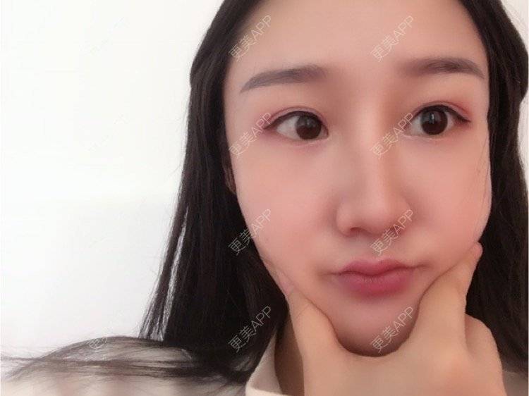 更美 - 更美用户KypVf5ovVE的经验 | 上海