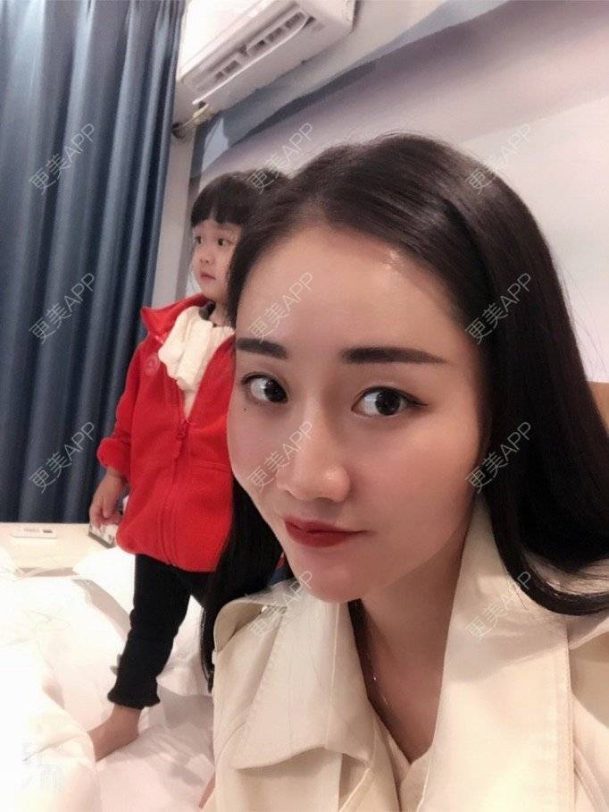 更美 - 更美用户KypVf5ovVE的经验 | 上海