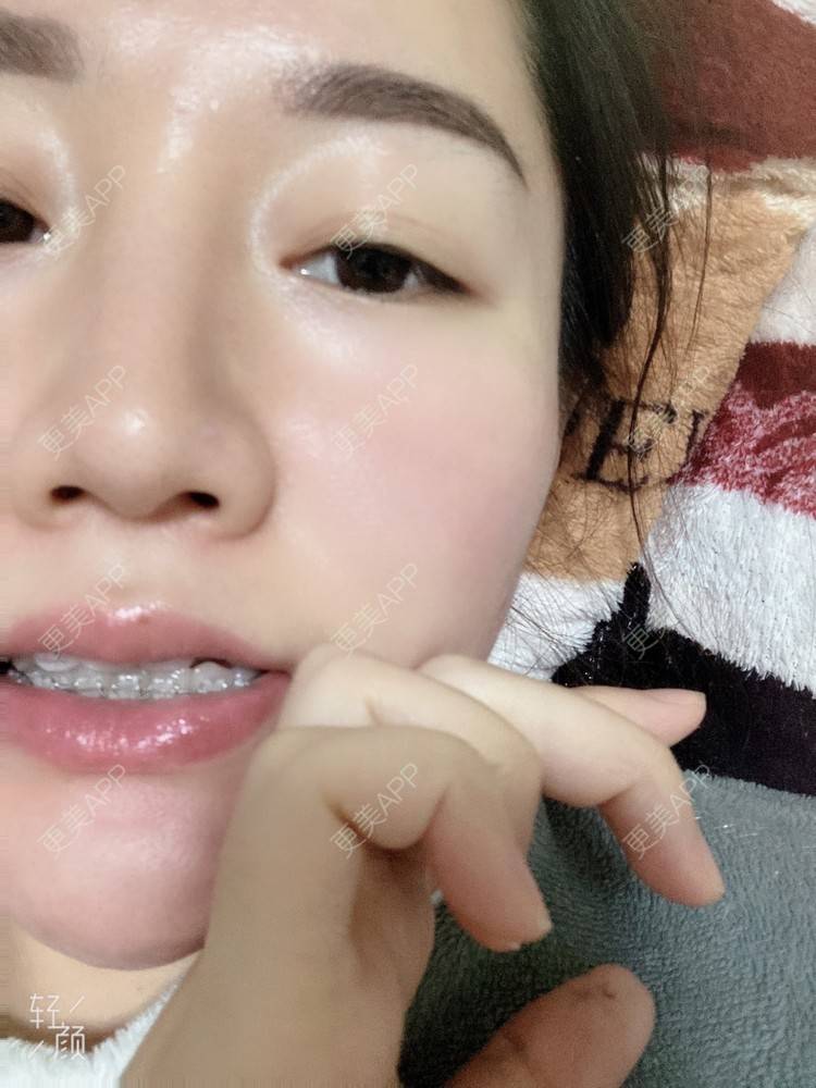 更美 - 更美用户KypVf5ovVE的经验 | 上海