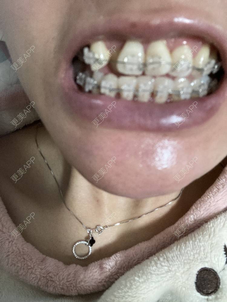 更美 - 更美用户KypVf5ovVE的经验 | 上海