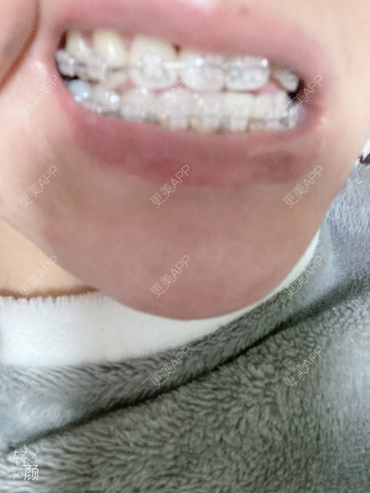 更美 - 更美用户KypVf5ovVE的经验 | 上海