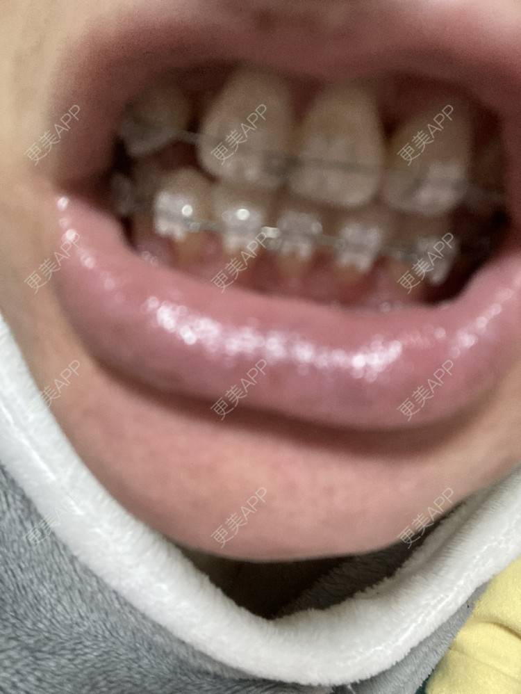 更美 - 更美用户KypVf5ovVE的经验 | 上海