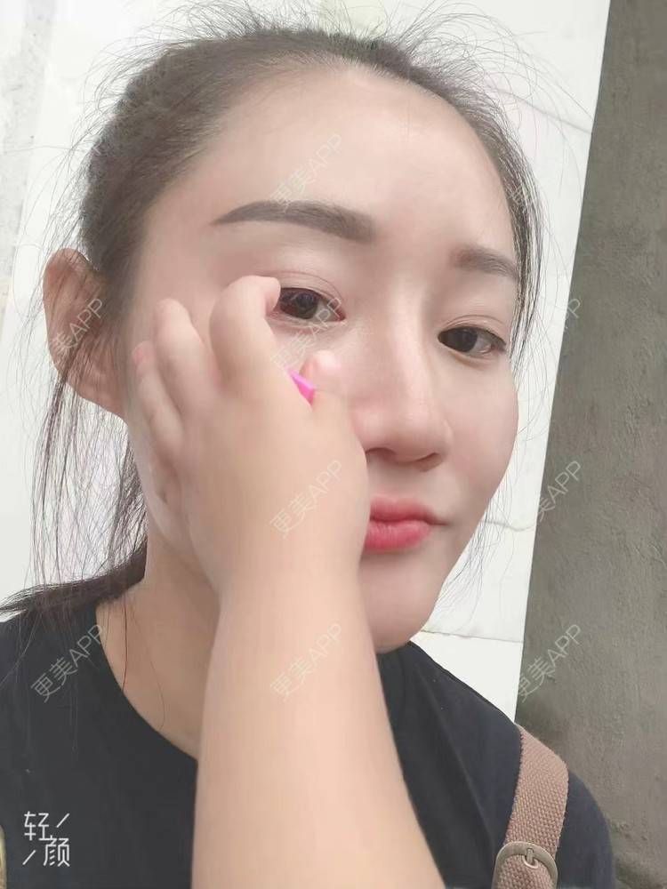 更美 - 更美用户KypVf5ovVE的经验 | 上海