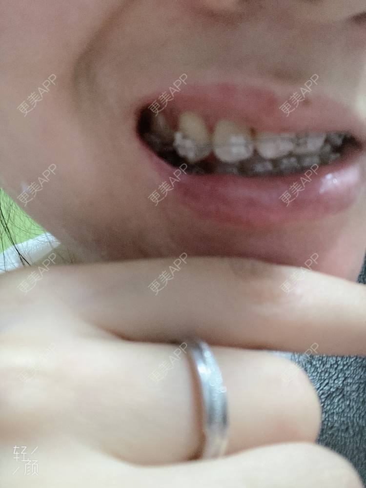 更美 - 更美用户KypVf5ovVE的经验 | 上海