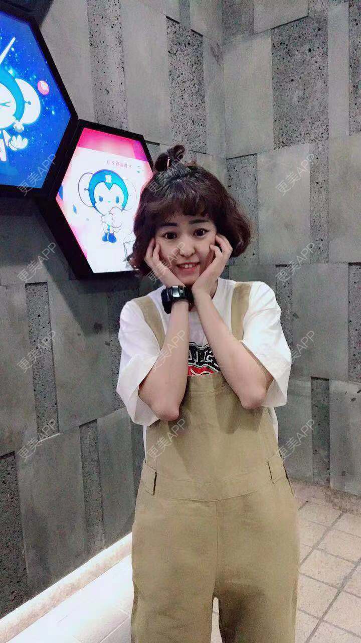 更美 - 更美用户PWR7uLOkkK的玻尿酸下巴经验 | 广州 | 玻尿酸下巴
