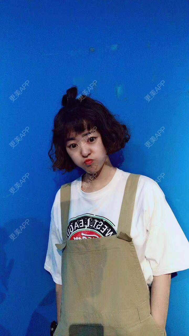 更美 - 更美用户PWR7uLOkkK的玻尿酸下巴经验 | 广州 | 玻尿酸下巴