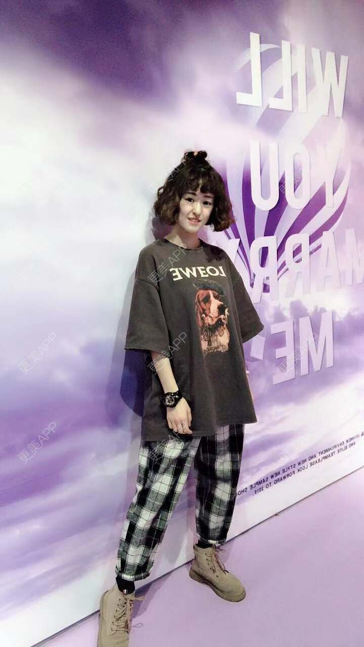更美 - 更美用户PWR7uLOkkK的玻尿酸下巴经验 | 广州 | 玻尿酸下巴