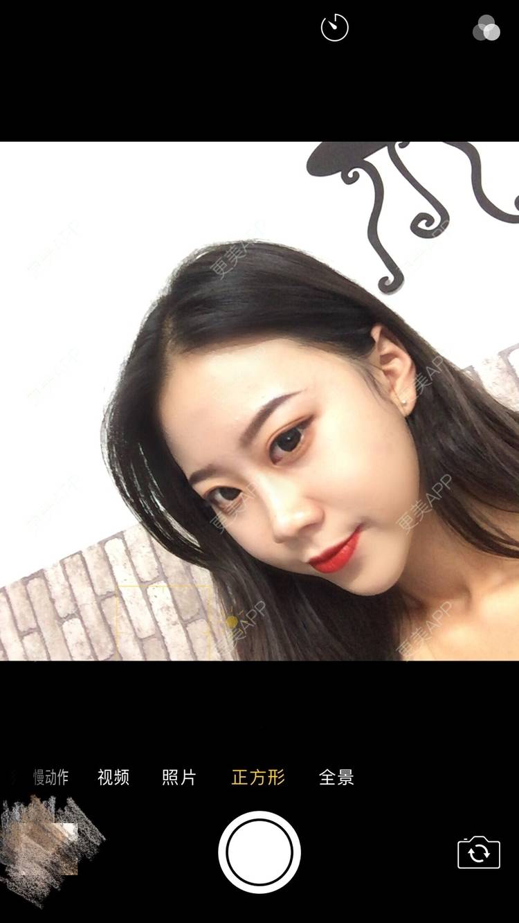 更美 - 更美用户vFETzv4uga的自体脂肪全面部填充经验 | 广州 | 自体脂肪全面部填充 | 视频日记