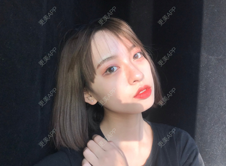 更美 - 更美用户M76UrSWMG4的鼻形态修复经验 | 鼻形态修复 | 长沙