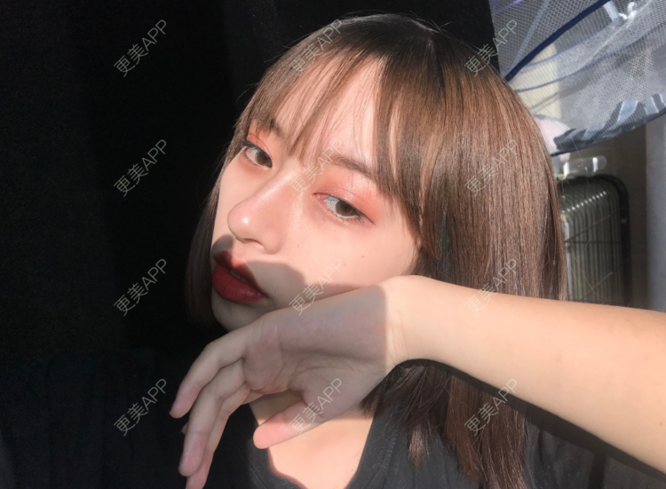 更美 - 更美用户M76UrSWMG4的鼻形态修复经验 | 鼻形态修复 | 长沙