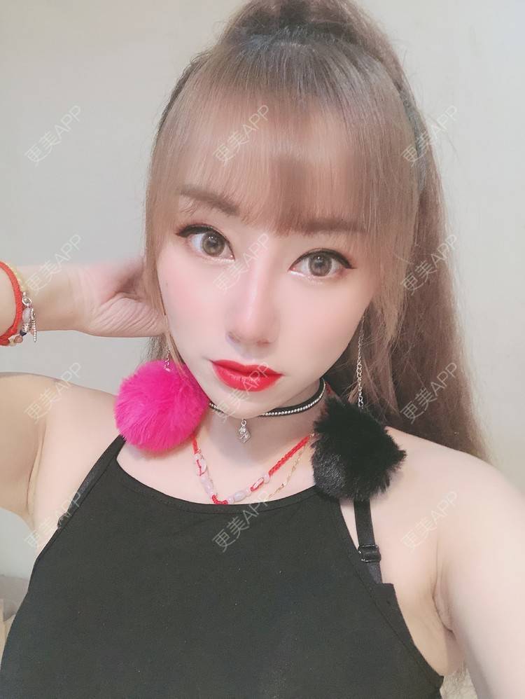 更美 - 画角声中仓的隆鼻经验 | 鼻形态修复 | 鼻中隔软骨隆鼻 | 膨体隆鼻 | 硅胶隆鼻 | 肋软骨隆鼻 | 玻尿酸鼻部 | 隆鼻 | 鼻部多项 | 耳软骨隆鼻 | 南宁