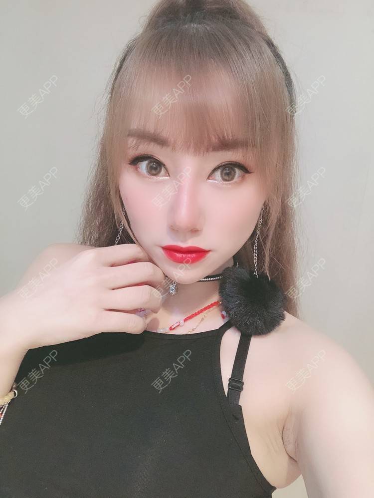 更美 - 画角声中仓的隆鼻经验 | 鼻形态修复 | 鼻中隔软骨隆鼻 | 膨体隆鼻 | 硅胶隆鼻 | 肋软骨隆鼻 | 玻尿酸鼻部 | 隆鼻 | 鼻部多项 | 耳软骨隆鼻 | 南宁