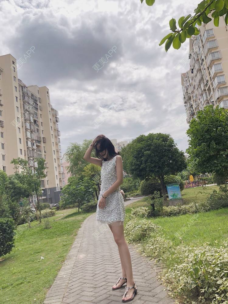 更美 - 更美用户npqbV13JPe的隆鼻经验 | 成都 | 视频日记 | 隆鼻