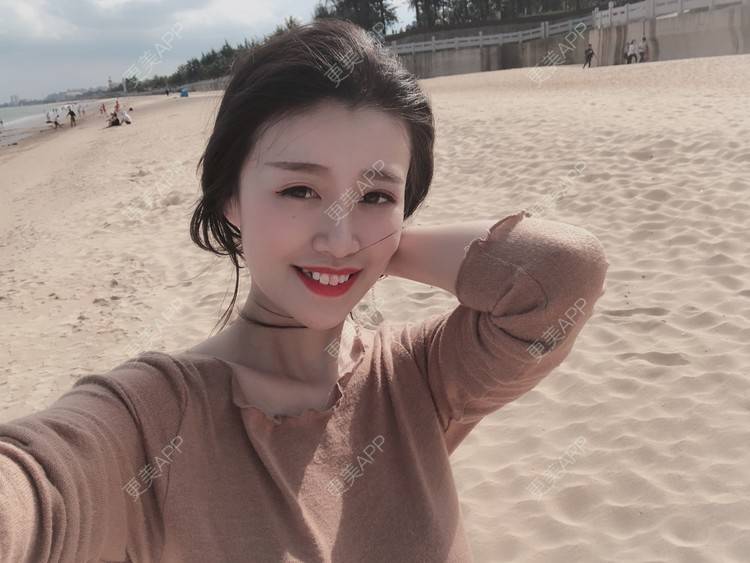 更美 - 更美用户npqbV13JPe的隆鼻经验 | 成都 | 视频日记 | 隆鼻