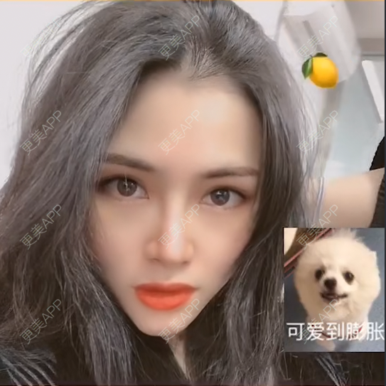 更美 - 西瓜不懂柠檬的酸√按的鼻部膨体假体取出经验 | 鼻形态修复 | 鼻中隔软骨隆鼻 | 鼻部硅胶假体取出 | 膨体隆鼻 | 硅胶隆鼻 | 鼻部膨体假体取出 | 肋软骨隆鼻 | 人工骨隆鼻 | 耳软骨隆鼻 | 南宁