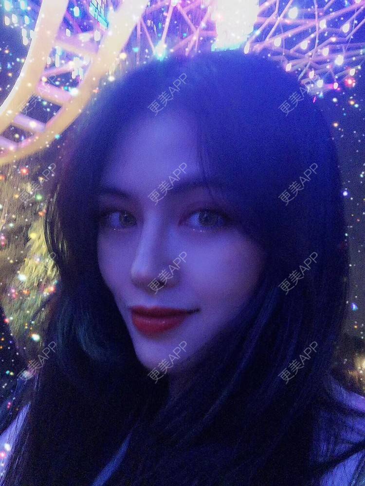 更美 - 西瓜不懂柠檬的酸√按的鼻部膨体假体取出经验 | 视频日记 | 鼻形态修复 | 鼻中隔软骨隆鼻 | 鼻部硅胶假体取出 | 膨体隆鼻 | 硅胶隆鼻 | 鼻部膨体假体取出 | 肋软骨隆鼻 | 人工骨隆鼻 | 耳软骨隆鼻 | 南宁