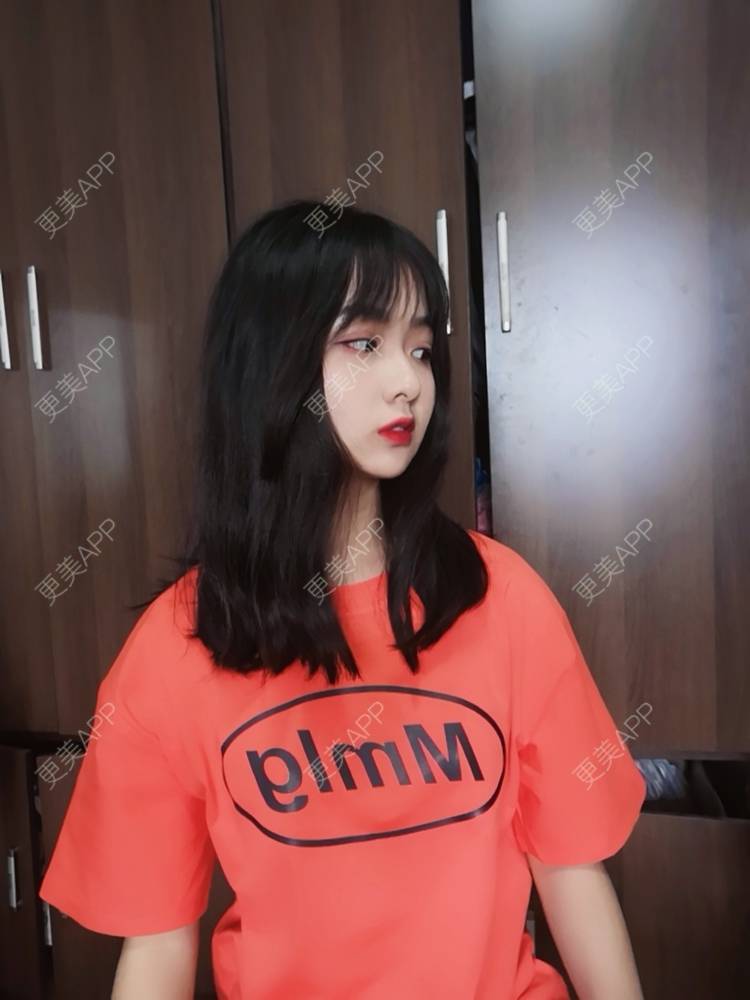 更美 - 笑笑生123的自体脂肪丰苹果肌经验 | 自体脂肪面部填充 | 自体脂肪全面部填充 | 自体脂肪丰面颊 | 自体脂肪丰太阳穴 | 自体脂肪丰额头 | 自体脂肪丰苹果肌 | 自体脂肪垫下巴 | 南宁