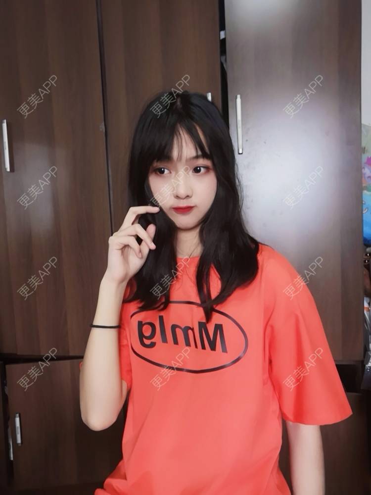 更美 - 笑笑生123的自体脂肪丰苹果肌经验 | 自体脂肪面部填充 | 自体脂肪全面部填充 | 自体脂肪丰面颊 | 自体脂肪丰太阳穴 | 自体脂肪丰额头 | 自体脂肪丰苹果肌 | 自体脂肪垫下巴 | 南宁