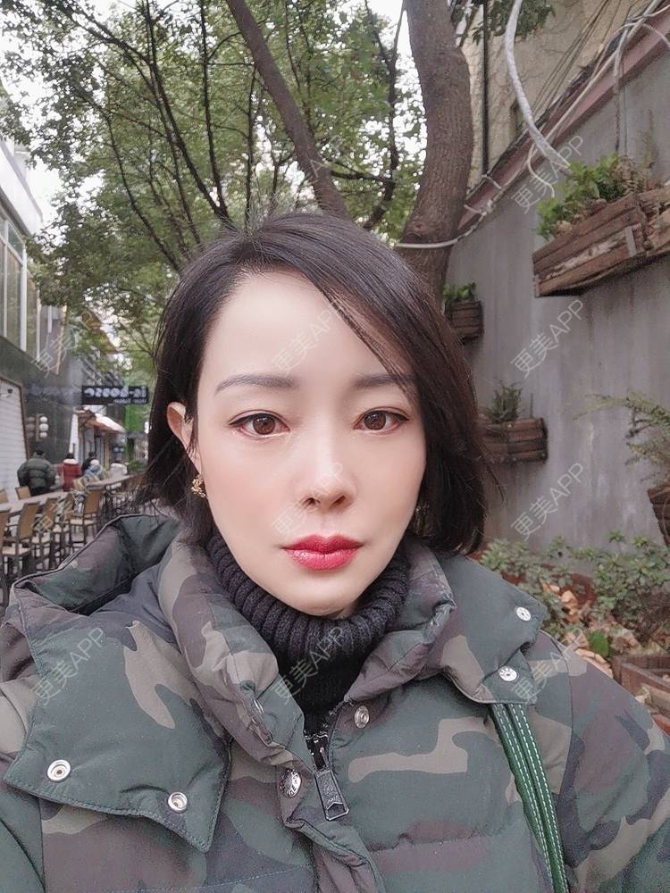 更美 - 🐷🐮仔仔仔的热玛吉经验 | 上海 | 热玛吉