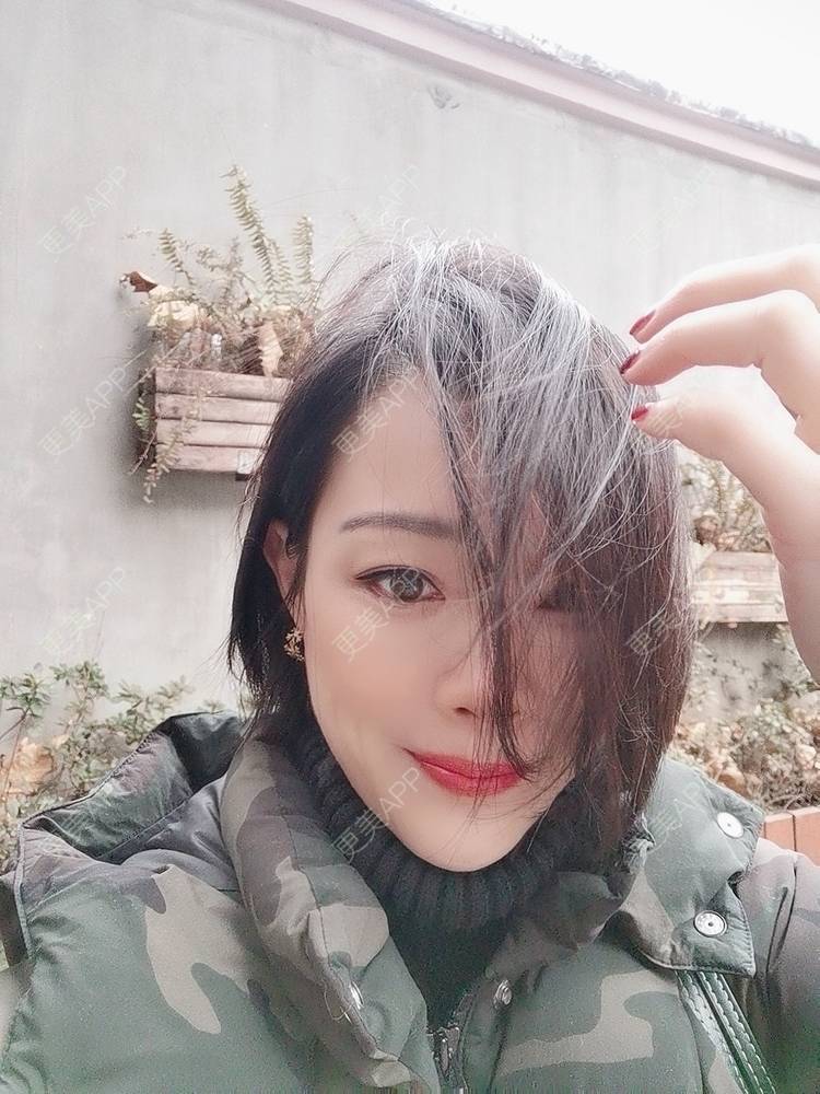 更美 - 🐷🐮仔仔仔的热玛吉经验 | 上海 | 热玛吉