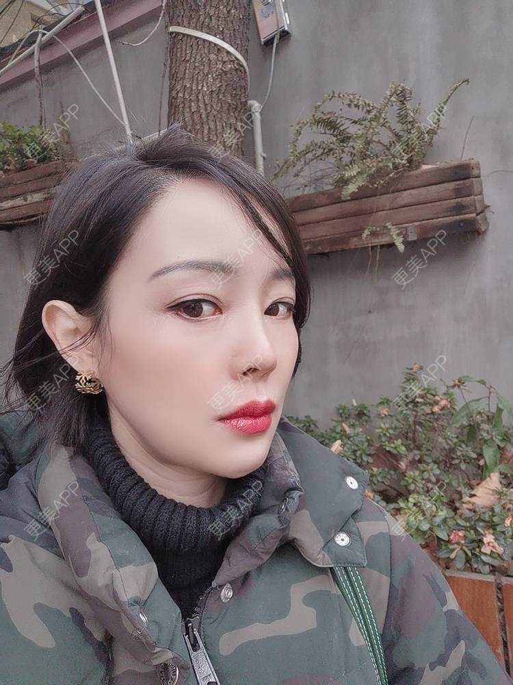 更美 - 🐷🐮仔仔仔的热玛吉经验 | 上海 | 热玛吉