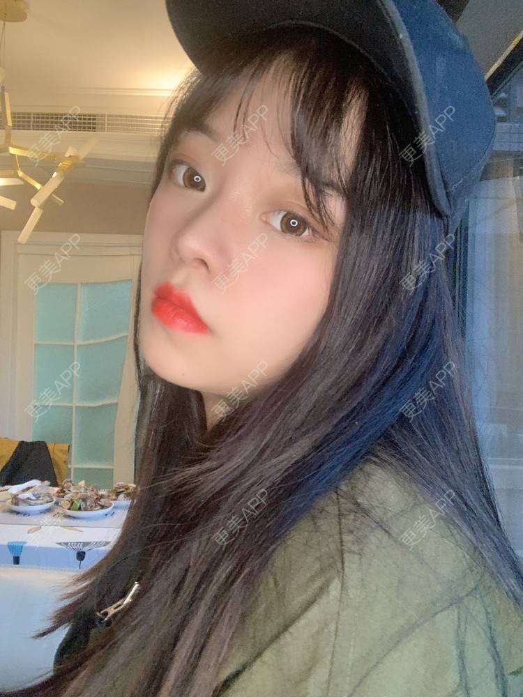 更美 - 即便晴天，内心也不温的眼部多项经验 | 北京 | 眼部多项 | 视频日记