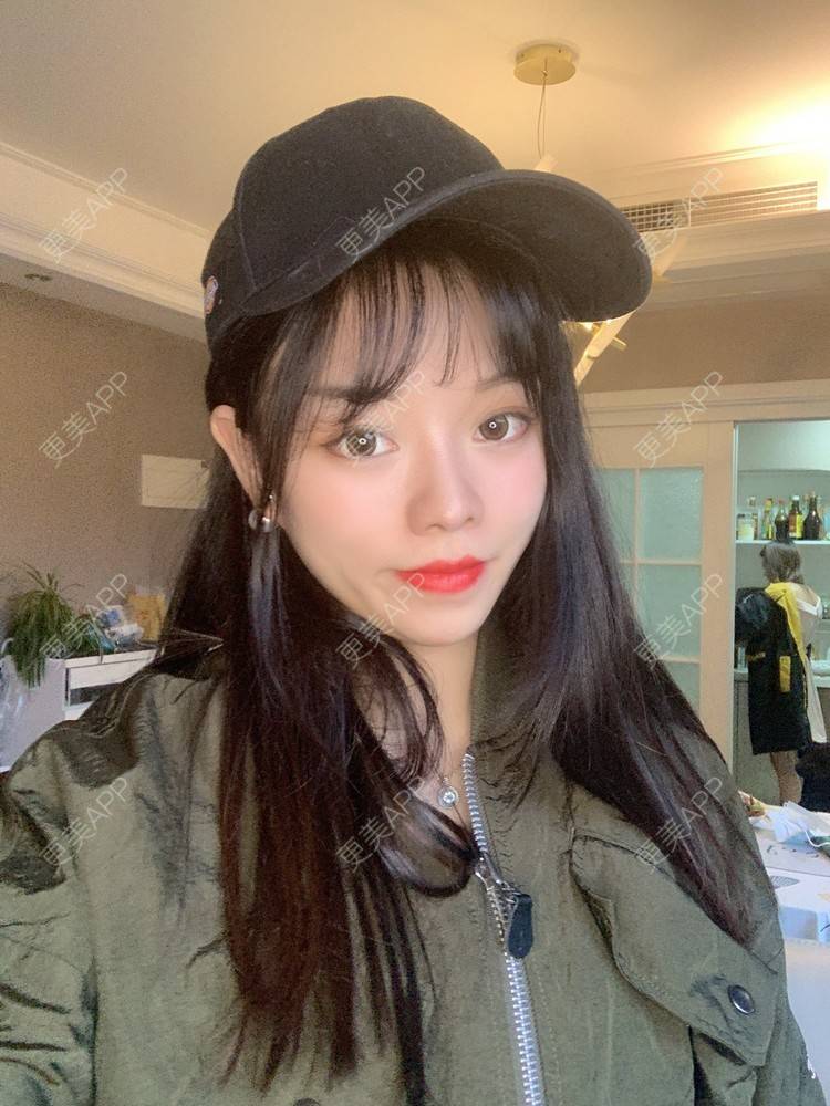 更美 - 即便晴天，内心也不温的眼部多项经验 | 北京 | 眼部多项 | 视频日记