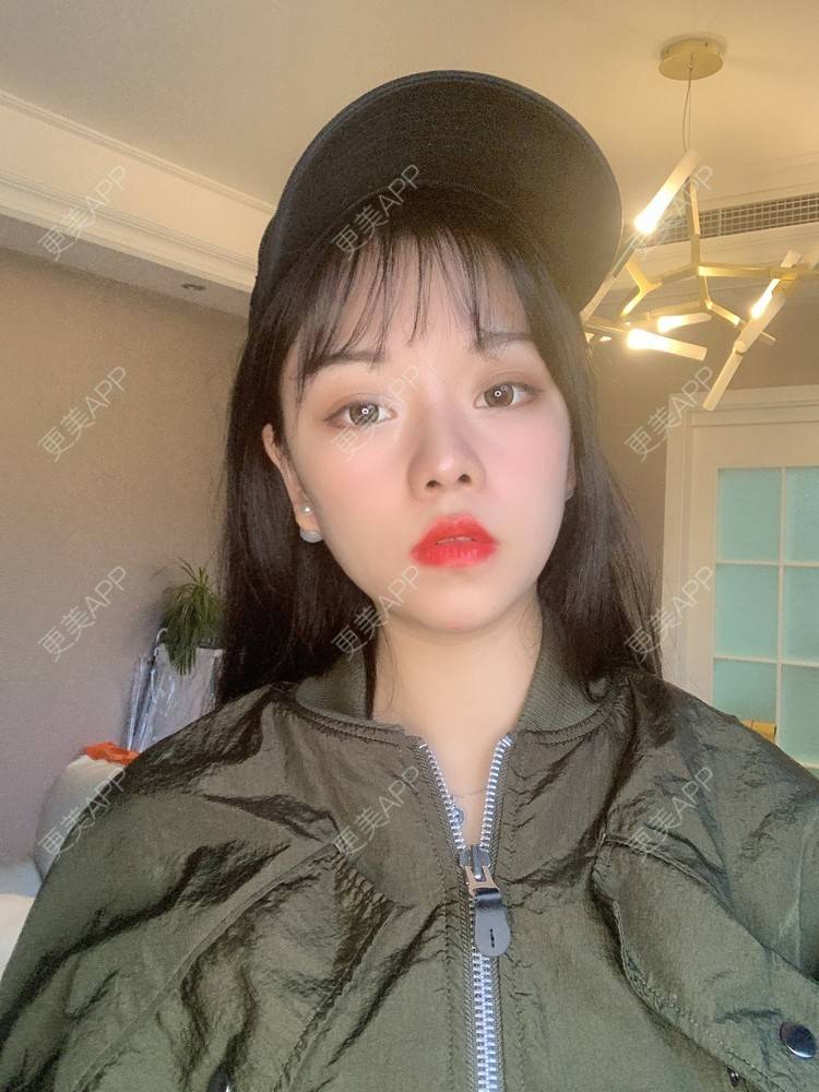 更美 - 即便晴天，内心也不温的眼部多项经验 | 北京 | 眼部多项 | 视频日记