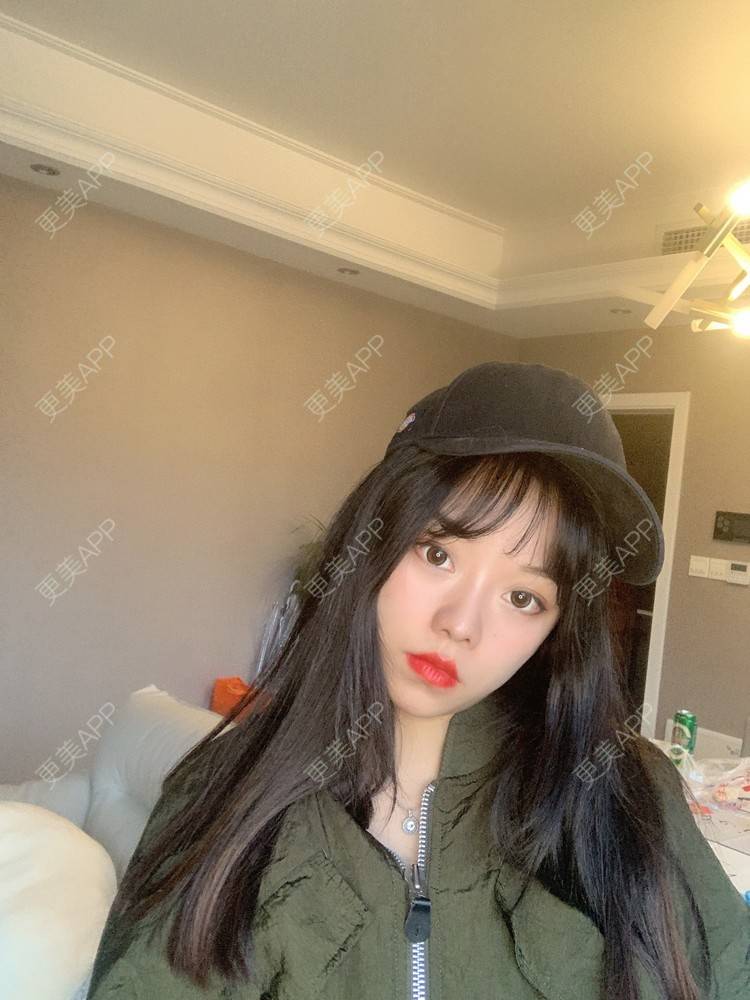 更美 - 即便晴天，内心也不温的眼部多项经验 | 北京 | 眼部多项 | 视频日记