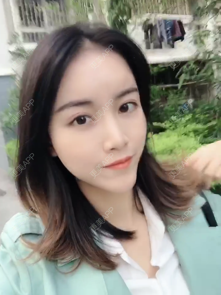 更美 - 更美用户X2RYKOTAXe的热玛吉经验 | 广州 | 热玛吉