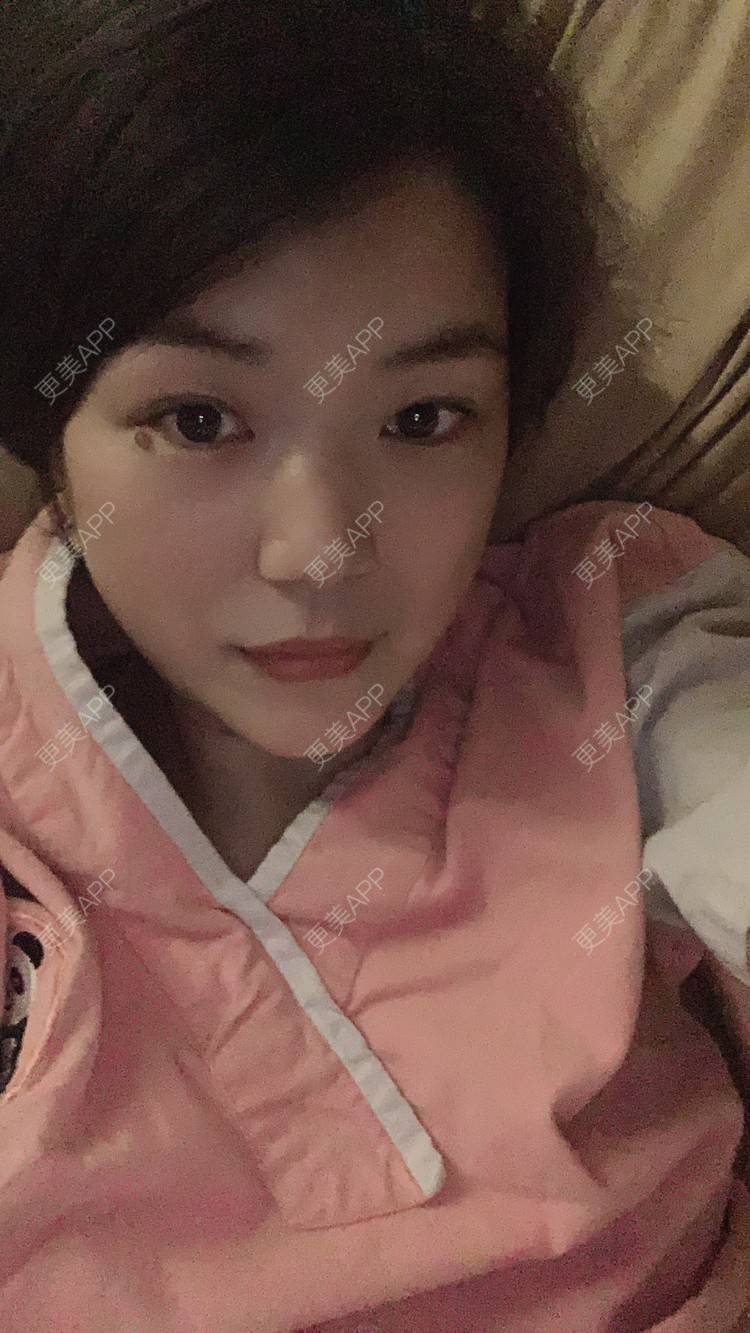 更美 - 小白蠢蠢的热玛吉经验 | 上海 | 热玛吉