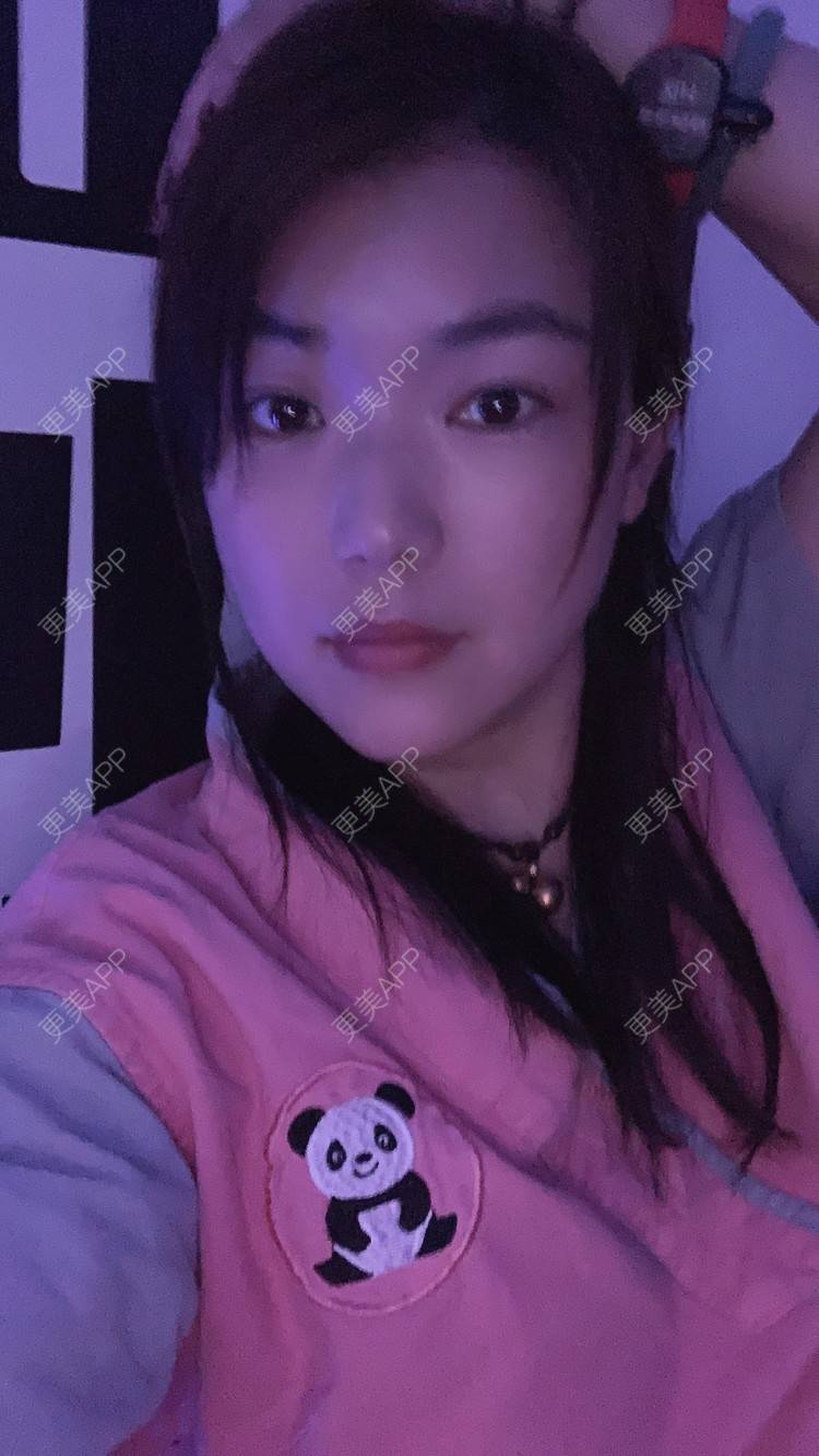 更美 - 小白蠢蠢的热玛吉经验 | 上海 | 热玛吉