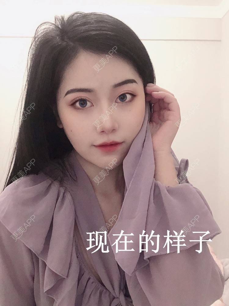 更美 - 更美用户qoOSp4cO9y的热玛吉经验 | 热玛吉 | 深圳