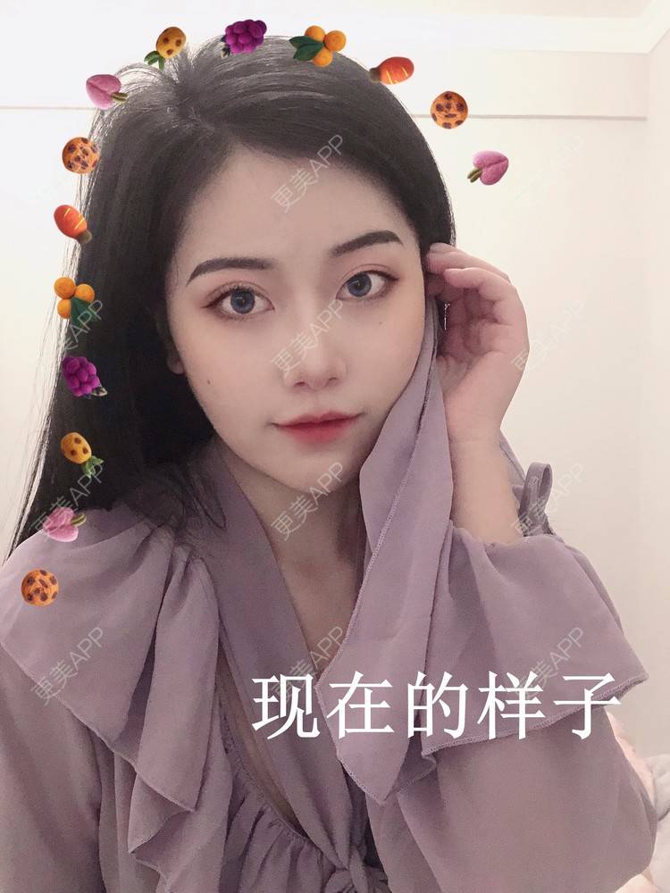 更美 - 更美用户qoOSp4cO9y的热玛吉经验 | 热玛吉 | 深圳
