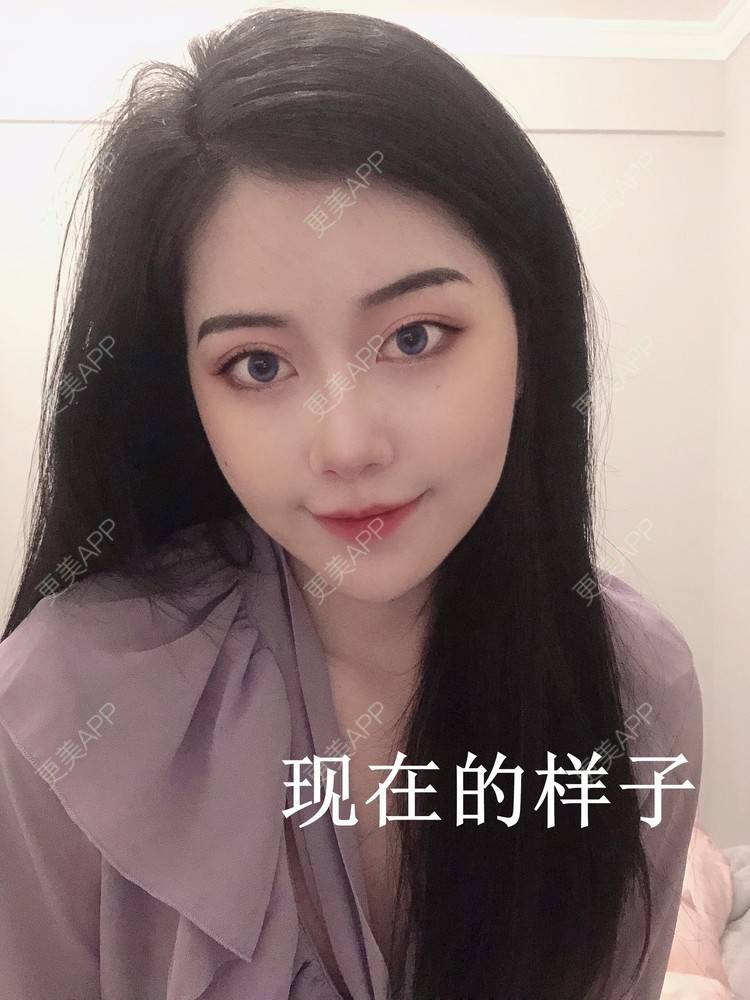 更美 - 更美用户qoOSp4cO9y的热玛吉经验 | 热玛吉 | 深圳