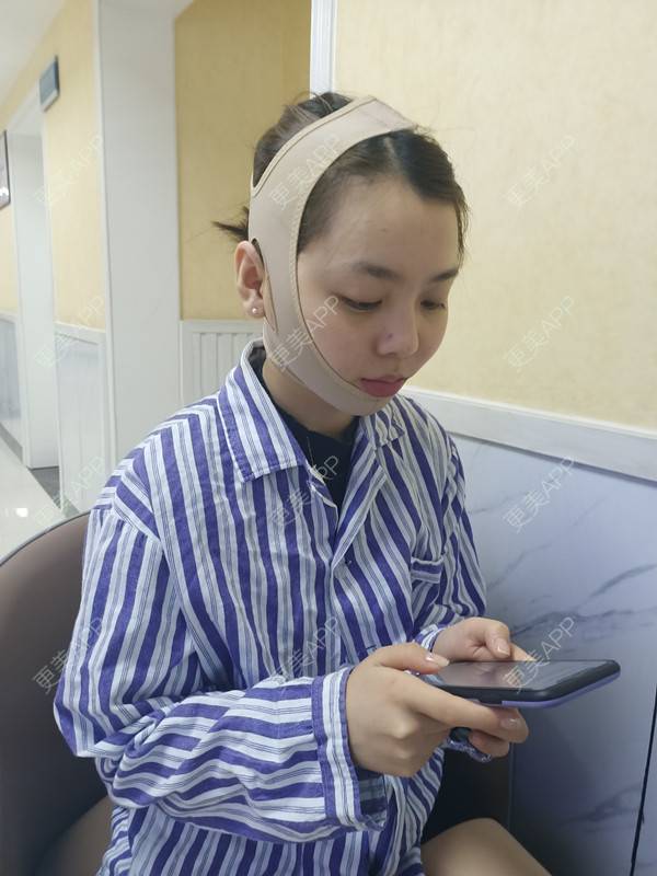更美 - 周萱萱周周的小切口手术提升经验 | 北京 | 小切口手术提升