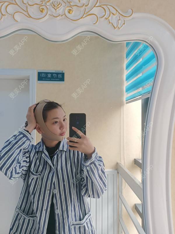 更美 - 周萱萱周周的小切口手术提升经验 | 北京 | 小切口手术提升