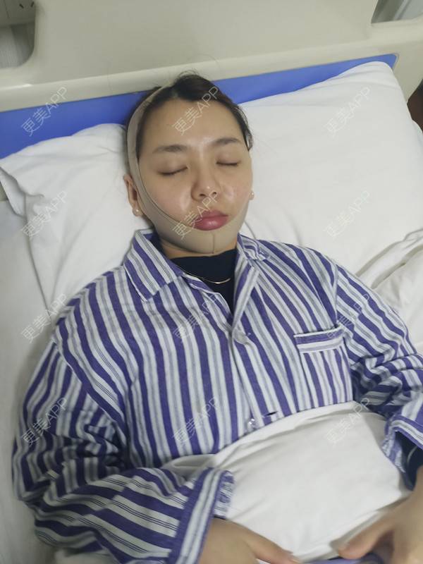 更美 - 周萱萱周周的小切口手术提升经验 | 北京 | 小切口手术提升