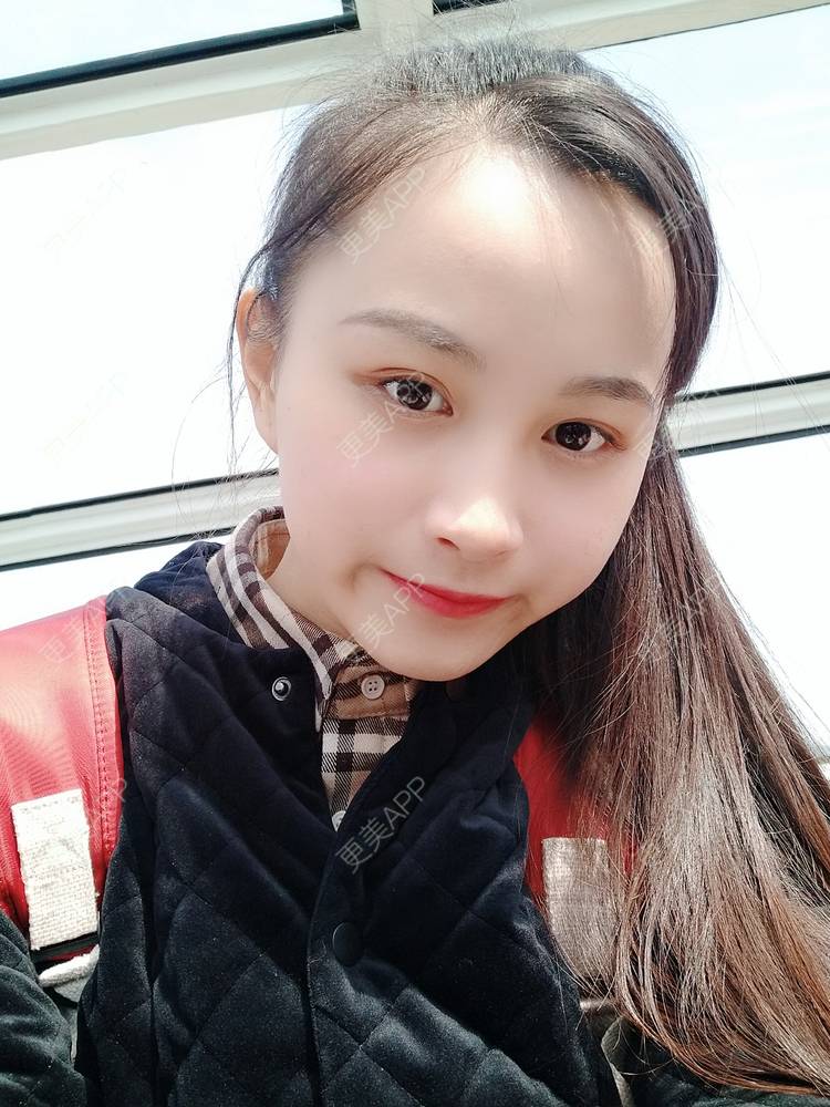 更美 - 更美用户Vge2UlmhsJ的黄金微针经验 | 黄金微针