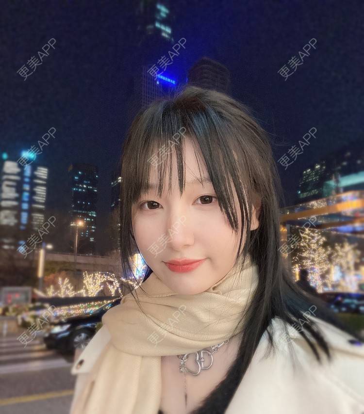 更美 - 更美用户91nh9woCEF的光纤溶脂经验 | 北京 | 光纤溶脂