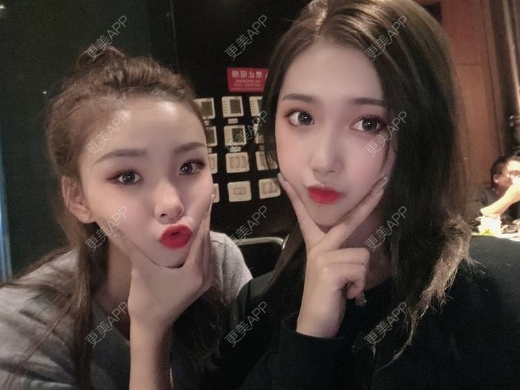 更美 - 奥特星人的祛眼袋经验 | 郑州 | 祛眼袋