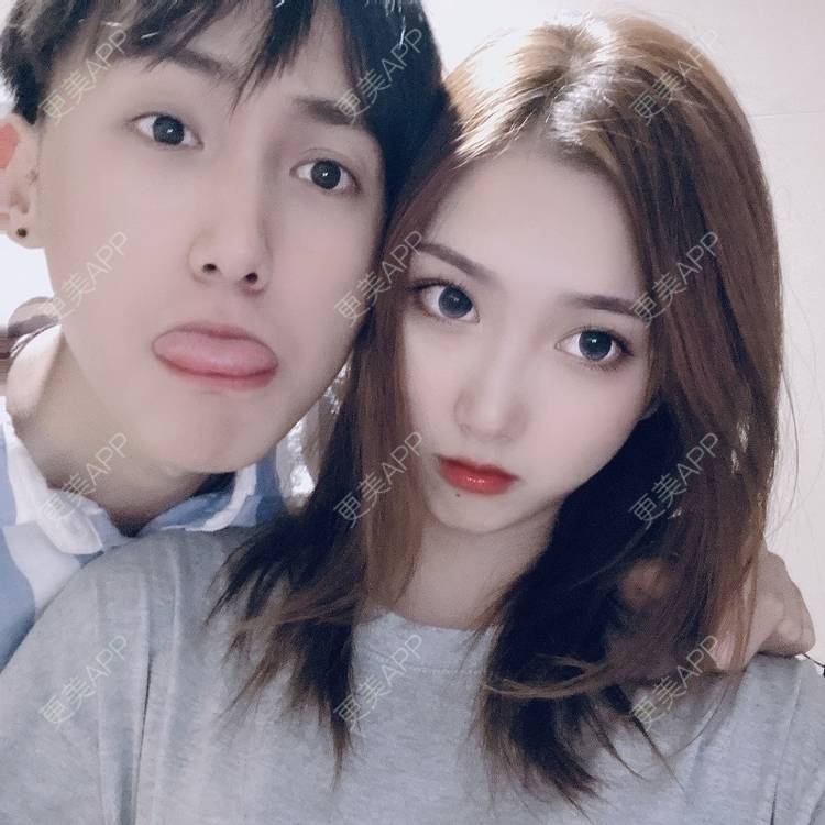 更美 - 奥特星人的祛眼袋经验 | 郑州 | 祛眼袋