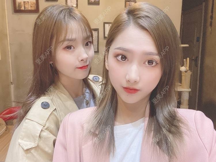 更美 - 奥特星人的祛眼袋经验 | 郑州 | 祛眼袋