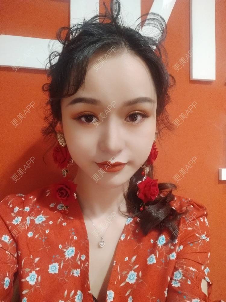 更美 - ─━═悲伤的夏夏的双眼皮经验 | 双眼皮 | 全切双眼皮 | 成都 | 更美研究所 | 原生自然双眼皮 | 视频日记