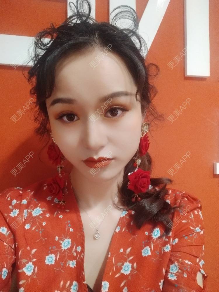 更美 - ─━═悲伤的夏夏的双眼皮经验 | 双眼皮 | 全切双眼皮 | 成都 | 更美研究所 | 原生自然双眼皮 | 视频日记