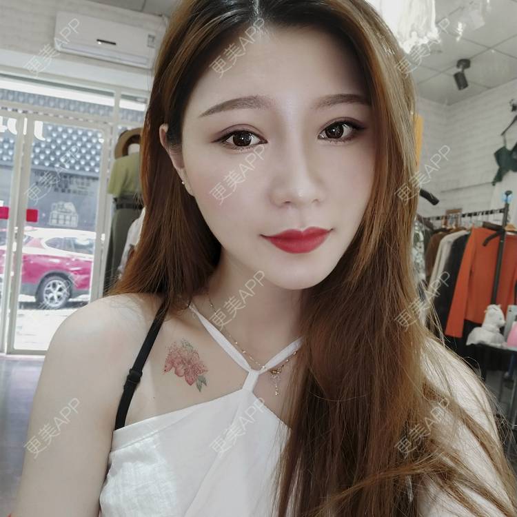 更美 - 更美用户LktNaylCvS的热玛吉经验 | 广州 | 热玛吉