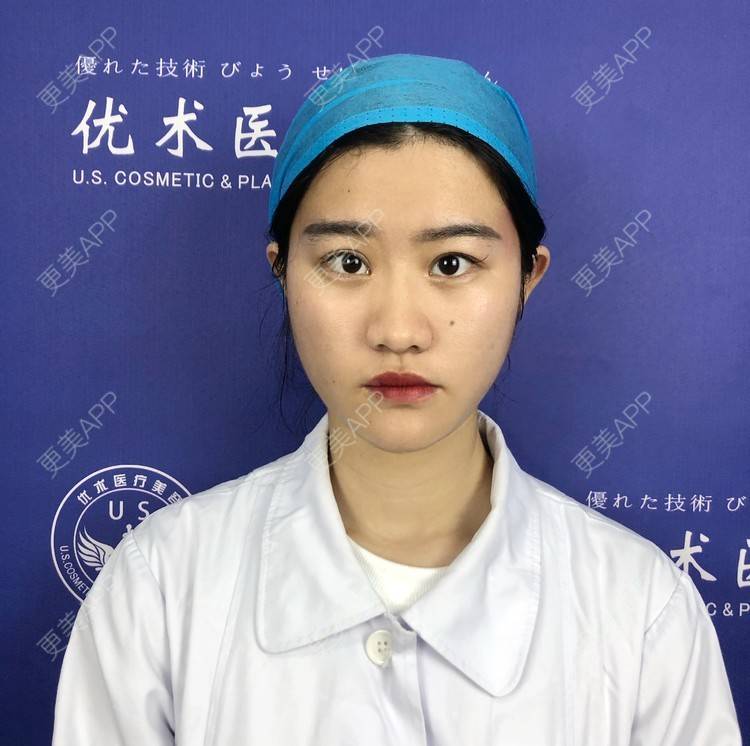 更美 - 更美用户aiJ3YxQeku的玻尿酸卧蚕经验 | 玻尿酸太阳穴 | 玻尿酸法令纹 | 玻尿酸黑眼圈 | 玻尿酸鼻基底 | 埋线提升 | 玻尿酸卧蚕 | 南昌