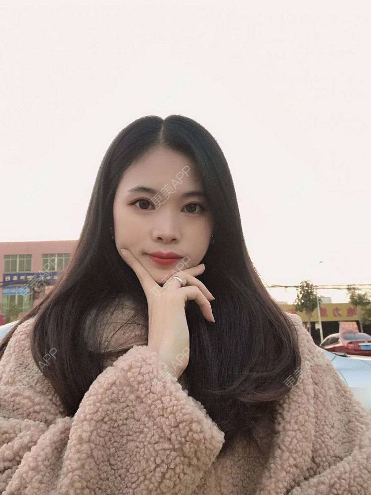 更美 - 更美^_^的眼部多项经验 | 眼部多项 | 广州