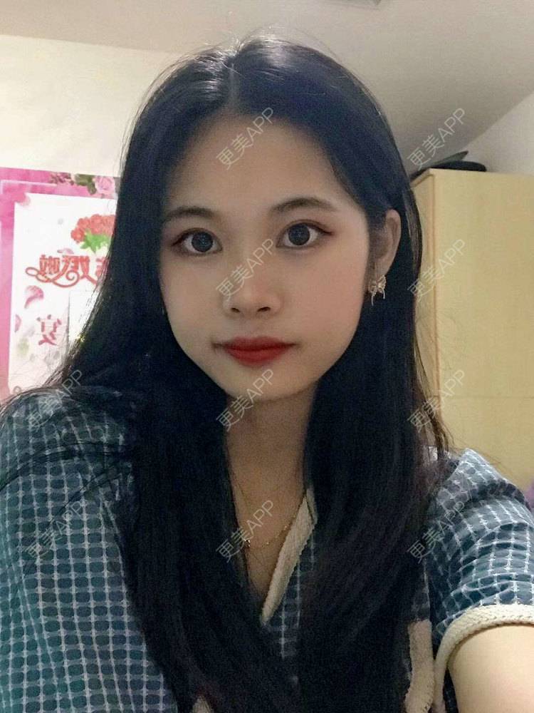 更美 - 更美^_^的眼部多项经验 | 眼部多项 | 广州